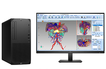 惠普（HP）Z1 G9 医疗成像电脑工作站（英特尔酷睿 i9-13900，24核丨32GB DDR5 内存丨512GB M.2 固态+2TB 机械硬盘丨NVIDIA T1000，8GB 显卡丨惠普27寸显示器）